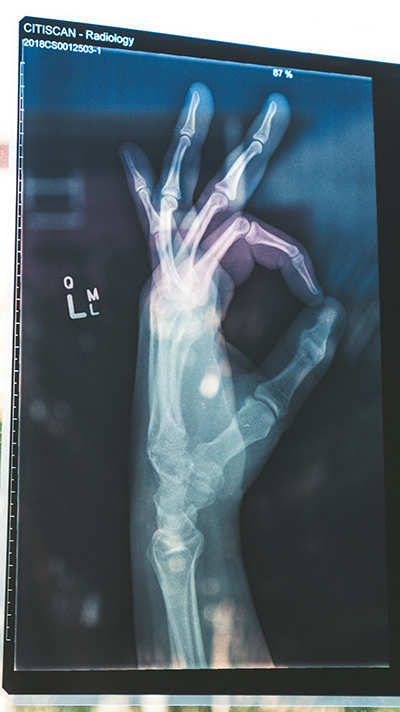 x-ray image of a hand making the OK sign